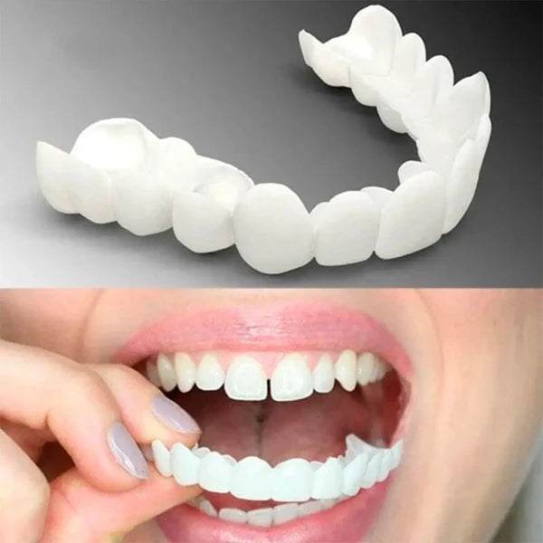 (Compre 1 Leve 2) Faceta Dental White Ajustável - Inferior e Superior | BRINDE CAPINHA PROTETORA e ESCOVA DE DENTE ELÉTRICA +FRETE GRÁTIS!