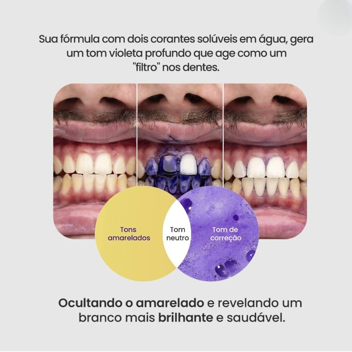 Clareador Dentário Sérum V34 - Clareamento Instantâneo (Últimas unidades🔥)