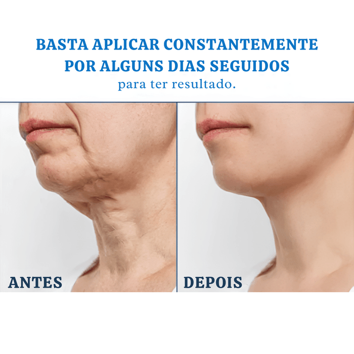 Creme de Pele Anti-Rugas e Flacidez Hoygi Skin Firming- Resultados rápidos (COMPRE 1 LEVE 2)