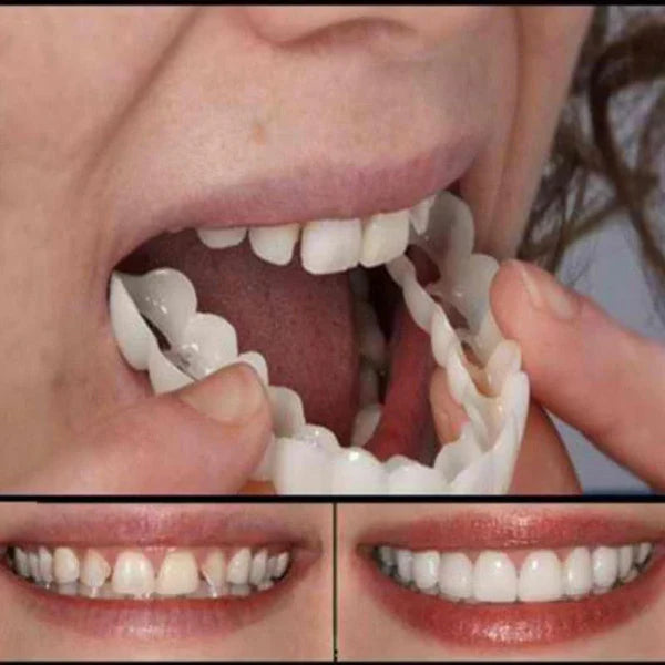 (Compre 1 Leve 2) Faceta Dental White Ajustável - Inferior e Superior | BRINDE CAPINHA PROTETORA e ESCOVA DE DENTE ELÉTRICA +FRETE GRÁTIS!