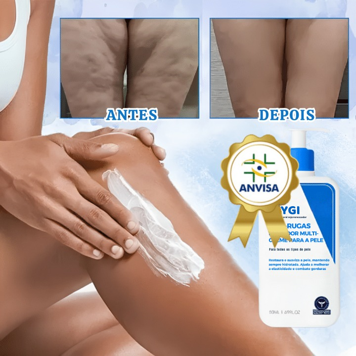 Creme de Pele Anti-Rugas e Flacidez Hoygi Skin Firming- Resultados rápidos (COMPRE 1 LEVE 2)