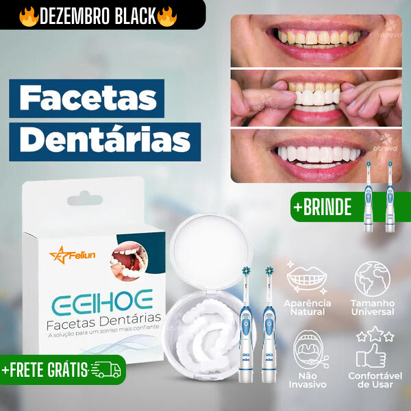 (Compre 1 Leve 2) Faceta Dental White Ajustável - Inferior e Superior | BRINDE CAPINHA PROTETORA e ESCOVA DE DENTE ELÉTRICA +FRETE GRÁTIS!